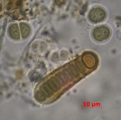 Cyanobacteria